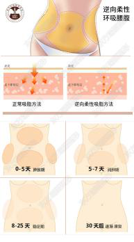 冬天的雪花